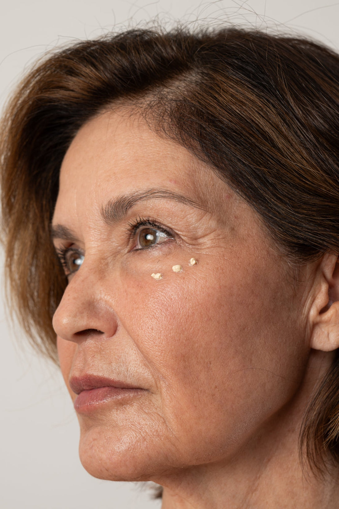 Pés de Galinha: como tratar e prevenir as linhas finas ao redor dos olhos