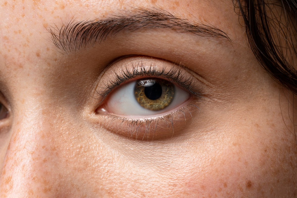Bolsas, flacidez, linhas finas e ressecamento: como cuidar da área dos olhos
