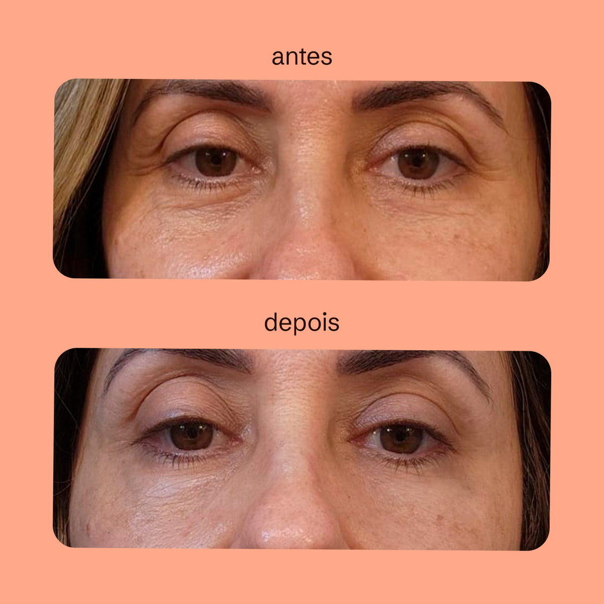 Creme para Área dos Olhos